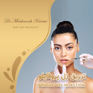 تزریق ژل پروفایلو